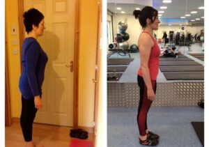 Lower Back Pain: How to Fix It for Good Without Giving UpKensington