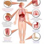 Fibromyalgia Support in Battersea: A Smarter Approach to Chronic Pain